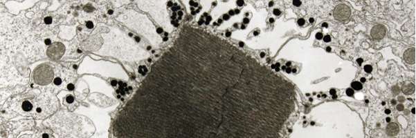 Primary Microscopes